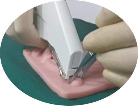 skin-stapler-indication.png skin-stapler-indication.png
